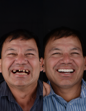 antes y despues web 1