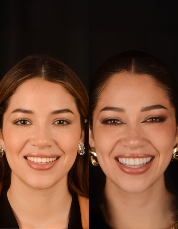 antes y despues web 2